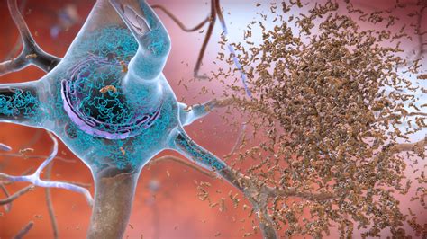 beta-amyloid plaques|A gene guiding brain cell growth may regulate Alzheimer’s plaque .